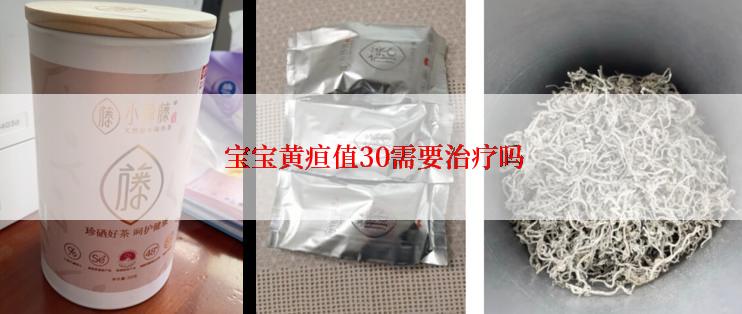  宝宝黄疸值30需要治疗吗